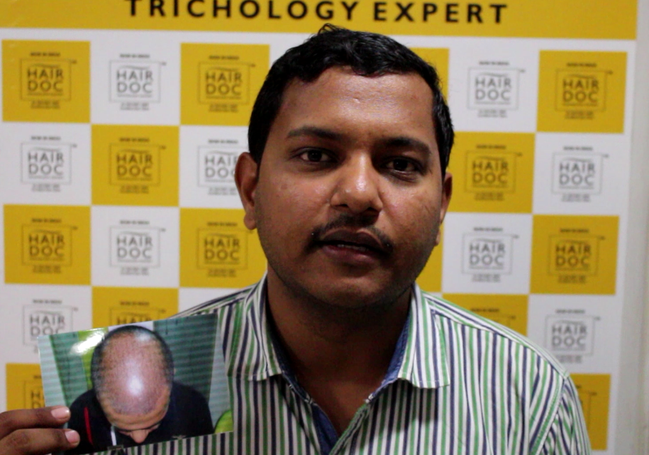 About us - Hairdoc Trichology Expert