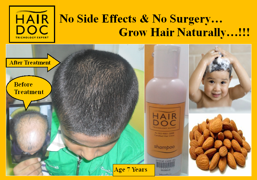 About us - Hairdoc Trichology Expert