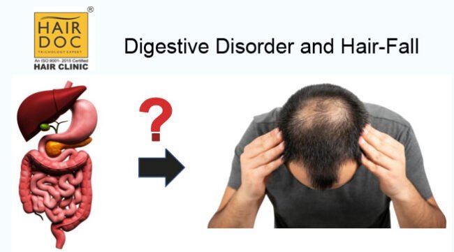 Digestive-Disorder-Hair-Fall