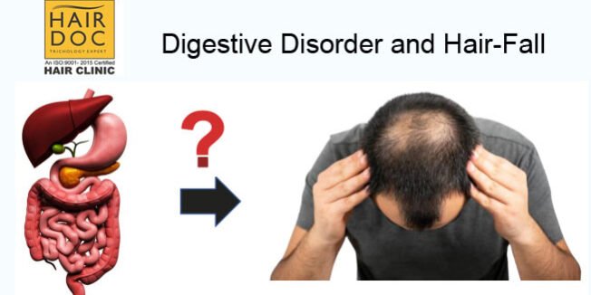 Digestive-Disorder-Hair-Fall