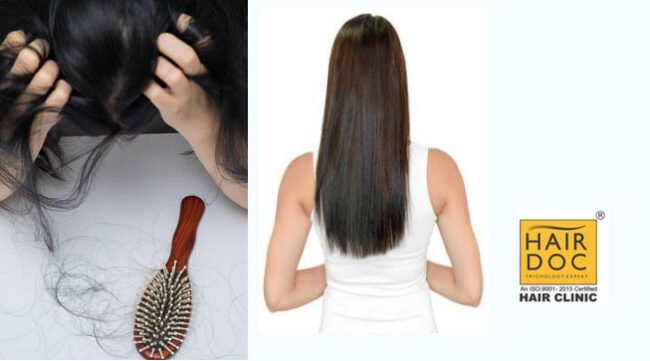 hair-loss-natural-way