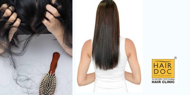 hair-loss-natural-way