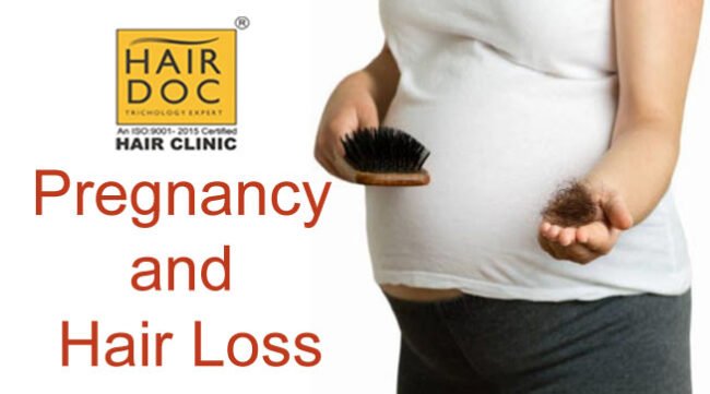 preganancy-and-hairloss