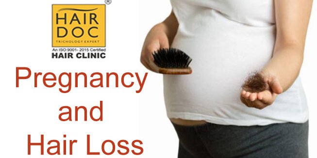 preganancy-and-hairloss