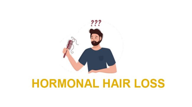 HORMONAL HAIR LOSS – CAUSES AND SOLUTION HORMONAL HAIR LOSS – CAUSES AND SOLUTION