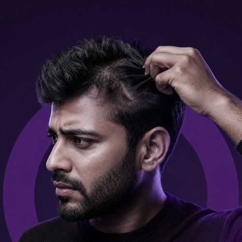 Hair Pulling Disorder