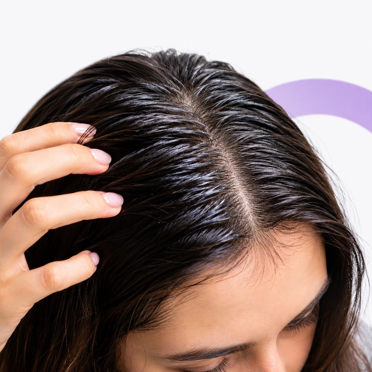 Excess scalp oil causing dandruff